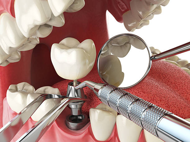 Reliable GA Emergency Dentist Solutions